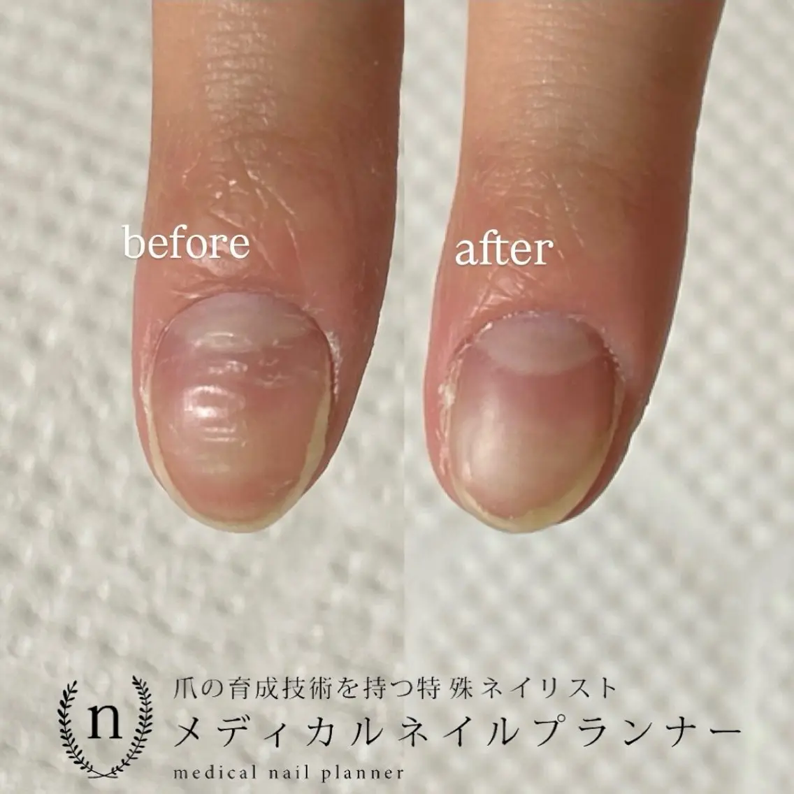 ネイル Lofinails ちひろのネイルデザイン