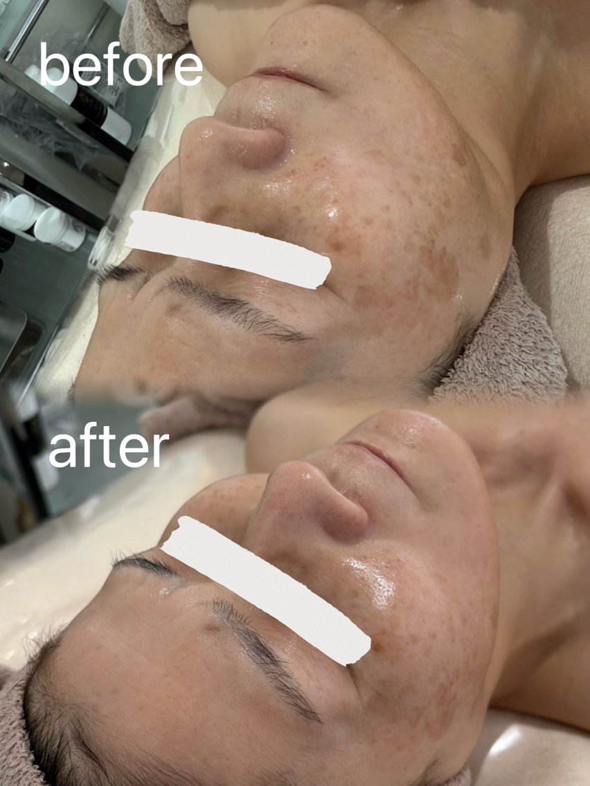 エステ初心者さんにおすすめ!レストセルトリートメントの写真