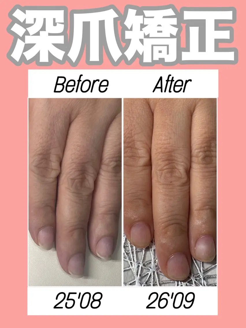 ネイル クリアネイル ジェルネイル ピンク ハンドネイル ハンドケア nail salon petillantのネイルデザイン