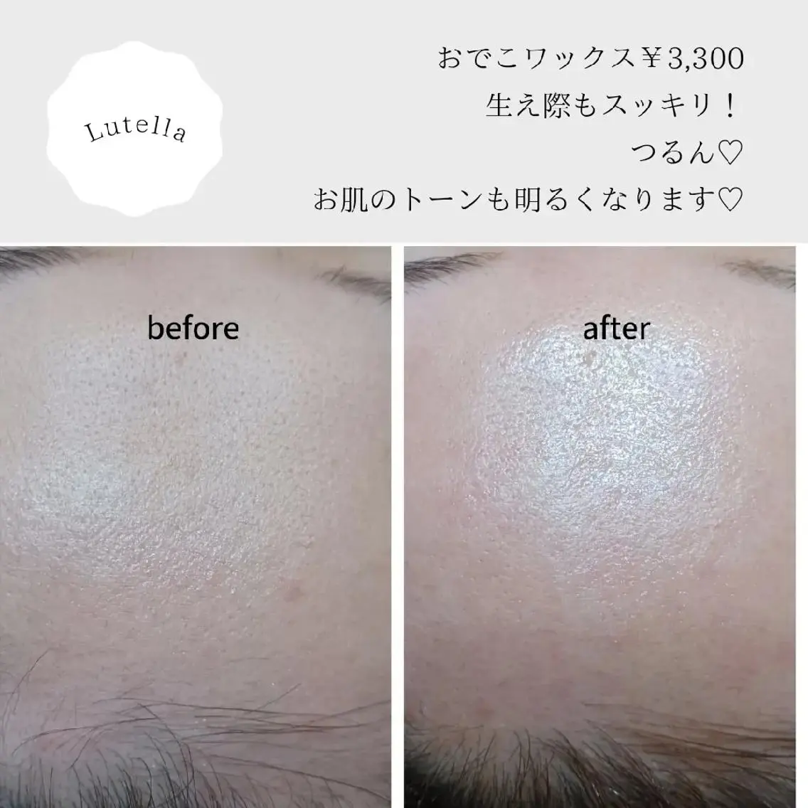 アイブロウ ワックス脱毛専門店 Lutellaのエステ・リラクイメージ