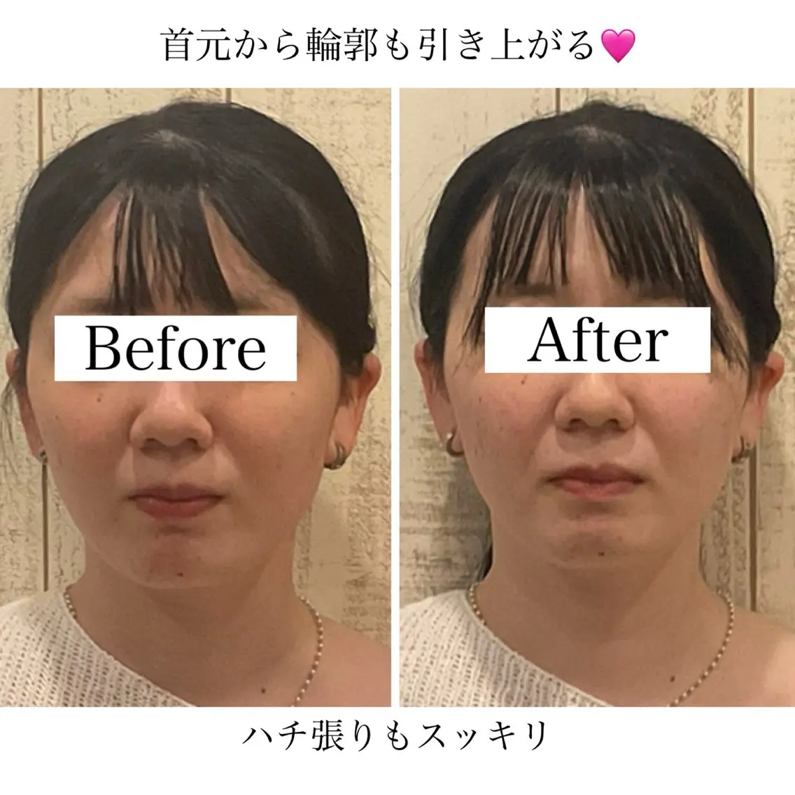 小顔矯正Speed KOGAO渋谷本店のエステ・リラクイメージ