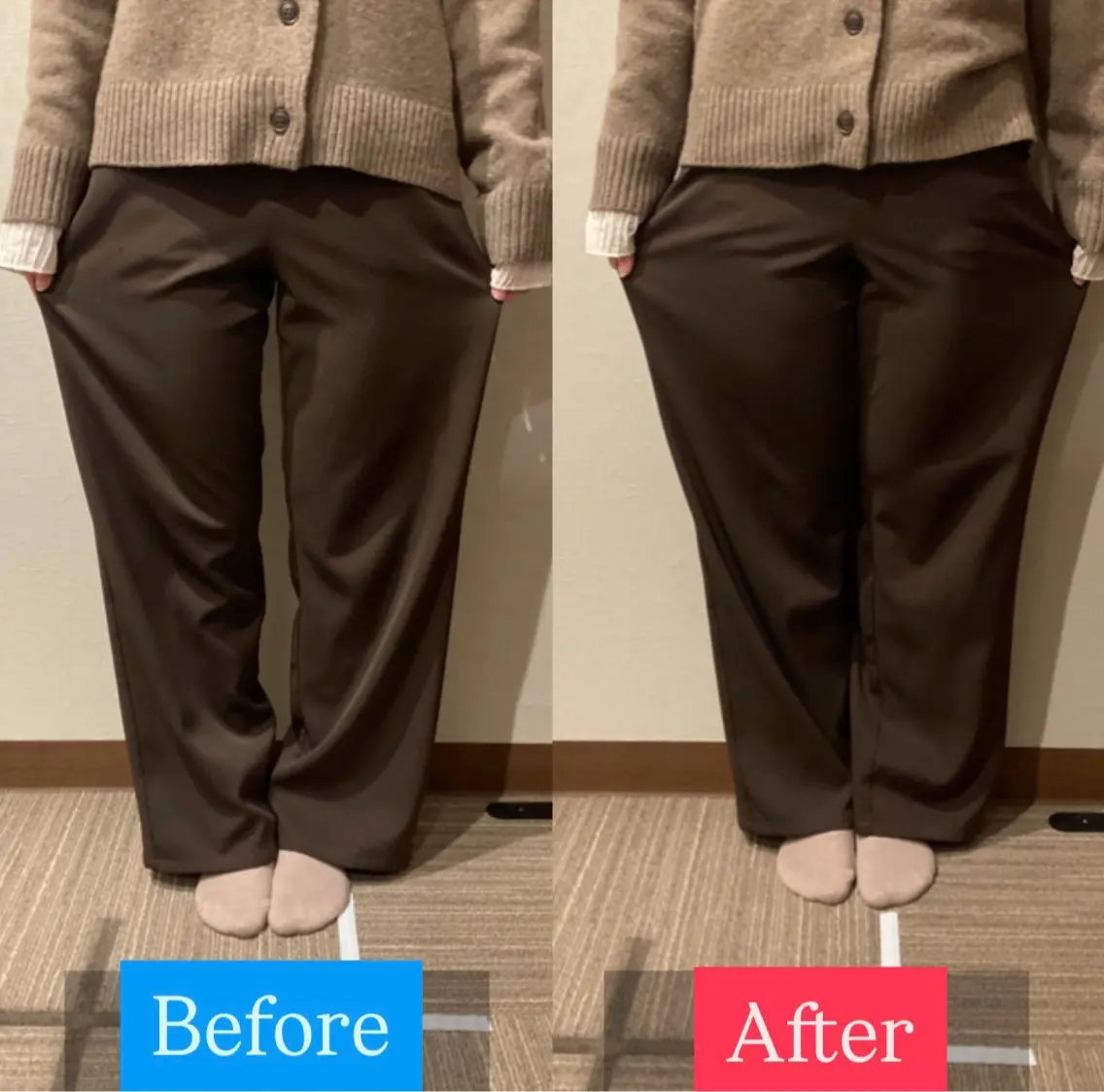 【O脚でお悩みの方！】立った際の脚の隙間を無くしましょう！の写真