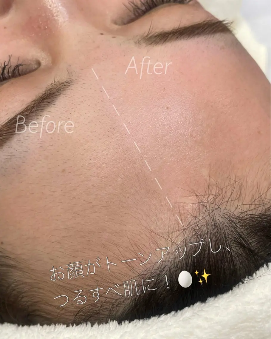 脱毛 HBL公式推奨サロン 渋谷 harukaの眉毛・アイブロウイメージ