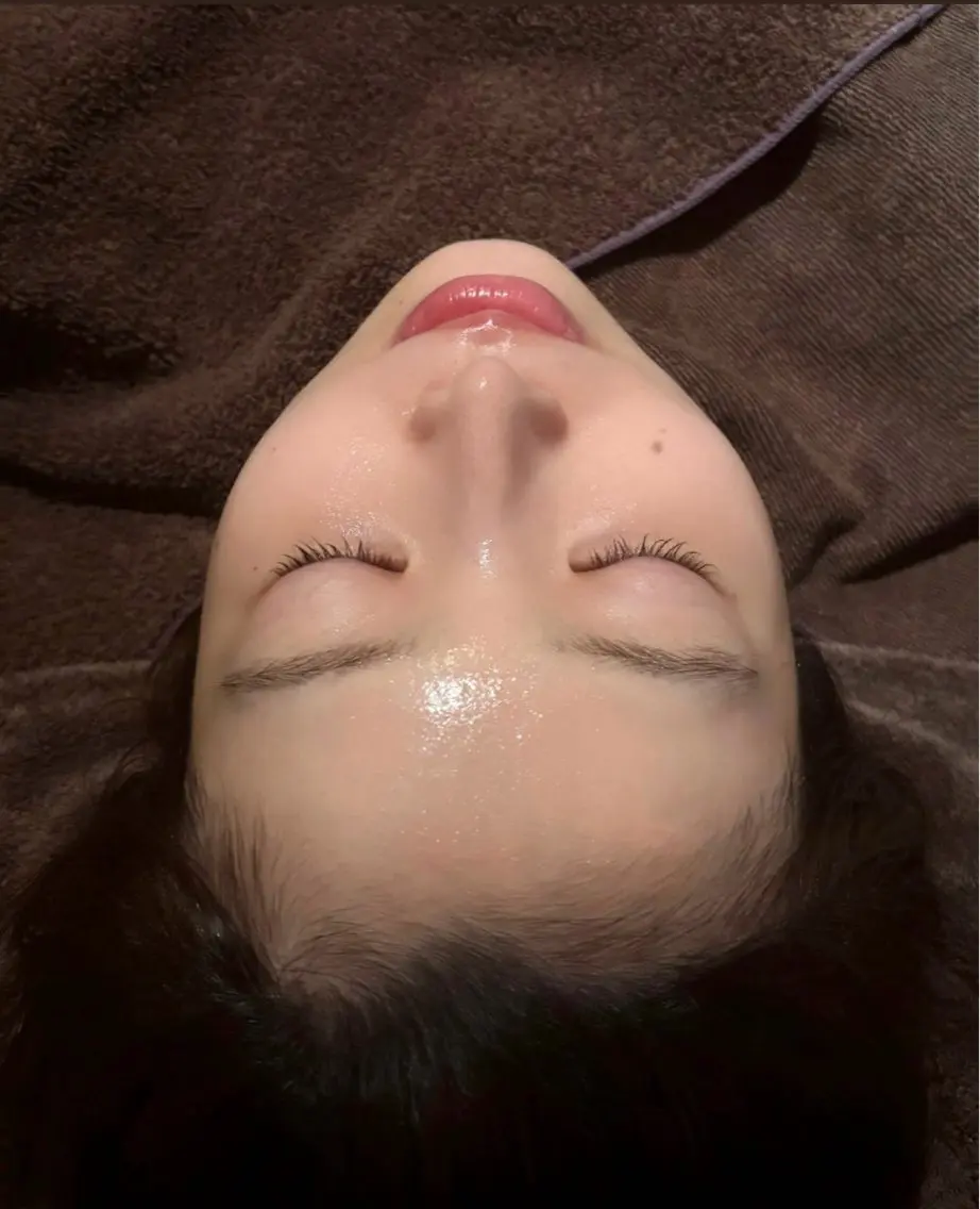 【透明感UP】お顔脱毛+美白パック|くすみ・うぶ毛ケア✨️ホームケアの浸透力up🩷の写真