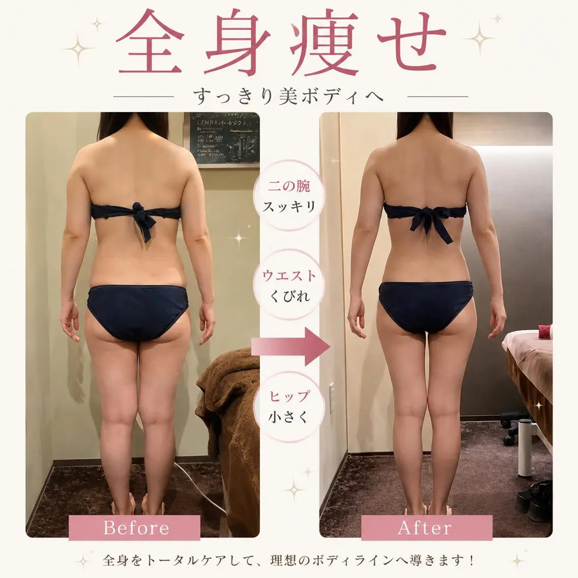 ✨【結果重視】痩せタイプ分析付✨7工程全身痩身90分🌻むくみ・肩こり・セルライト・ボディラインを徹底ケア💛の写真