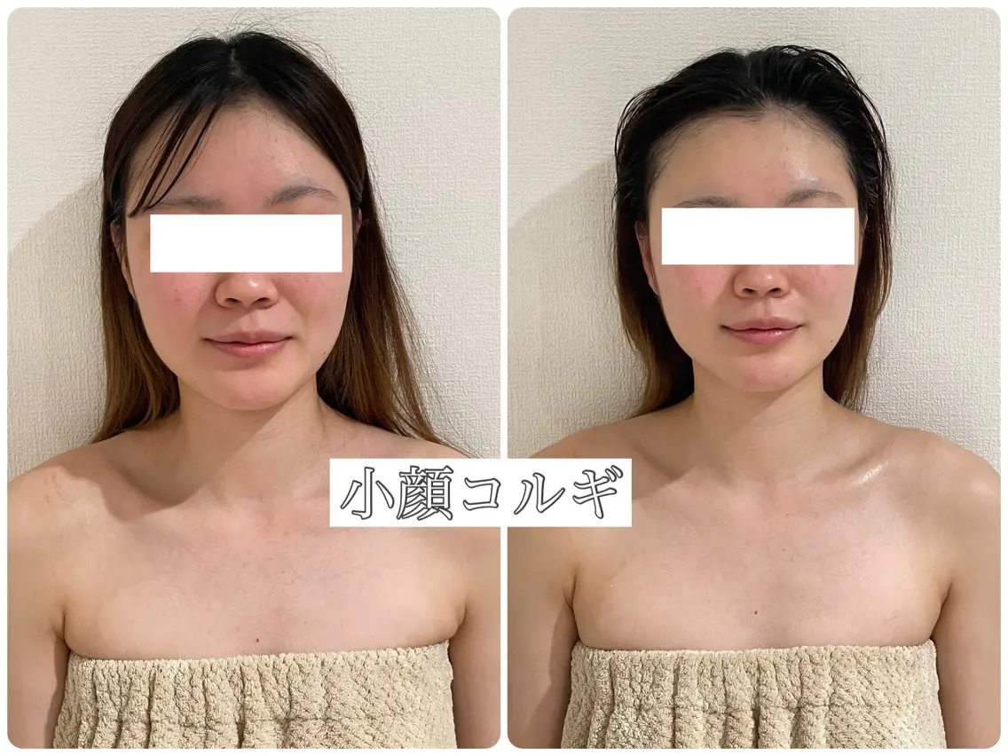 🌿小顔矯正コルギ練習モデル価格🌿の写真