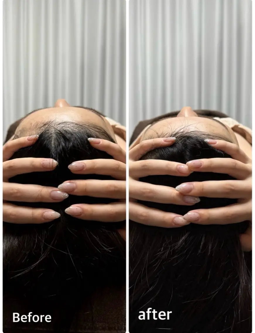 大人気！！【究極の小顔コース！！】頭蓋骨矯正付き100min❣️【¥22,000→¥4,950】の写真
