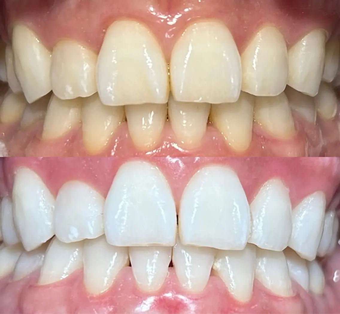 io teeth careのその他イメージ