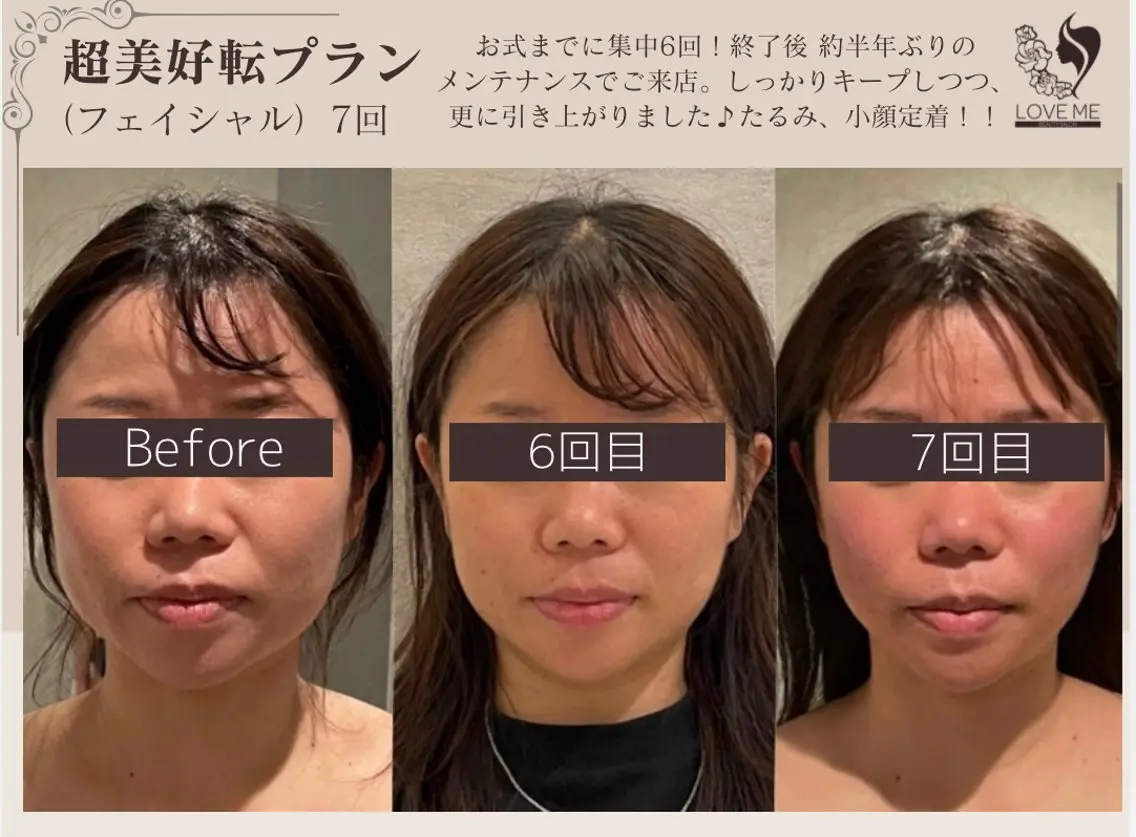 総合美容サロン LOVEME渋谷本店のエステ・リラクイメージ
