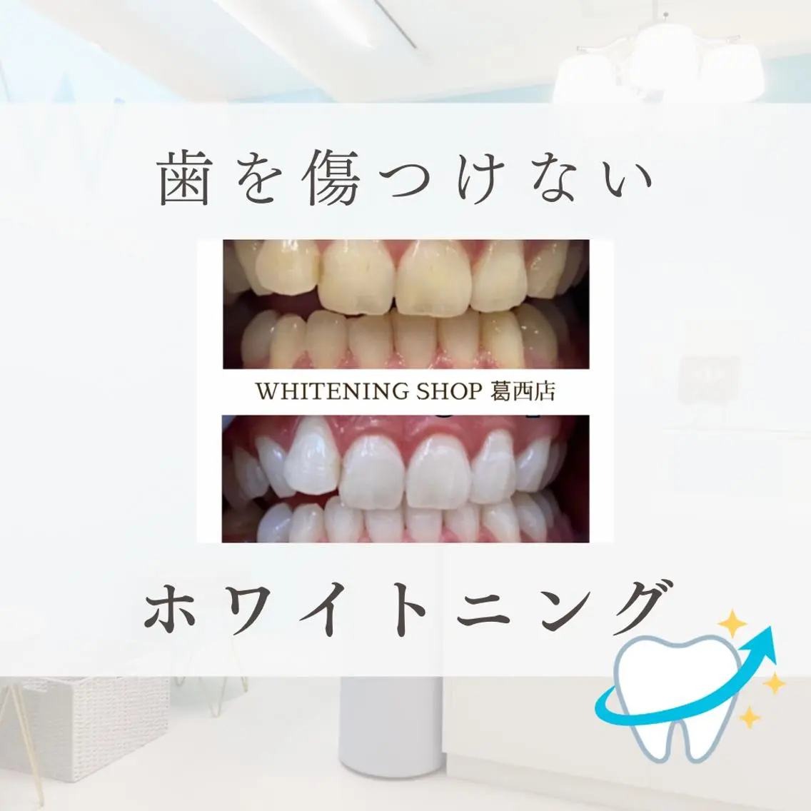 メンズ その他 ホワイトニング ショップ葛西店のその他イメージ