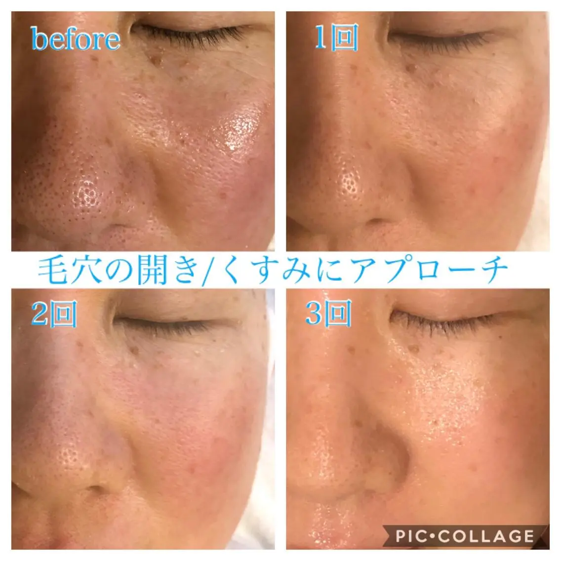 ミディアム カラー パーマ ヘアアレンジ メンズ ネイル マツエク・マツパ エステ リラク EnsorClair 代表 野口真央のエステ・リラクイメージ