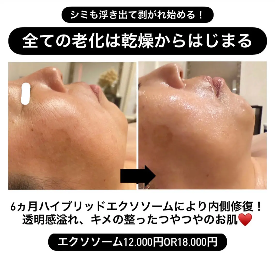 エステ 太田 女久美のエステ・リラクイメージ