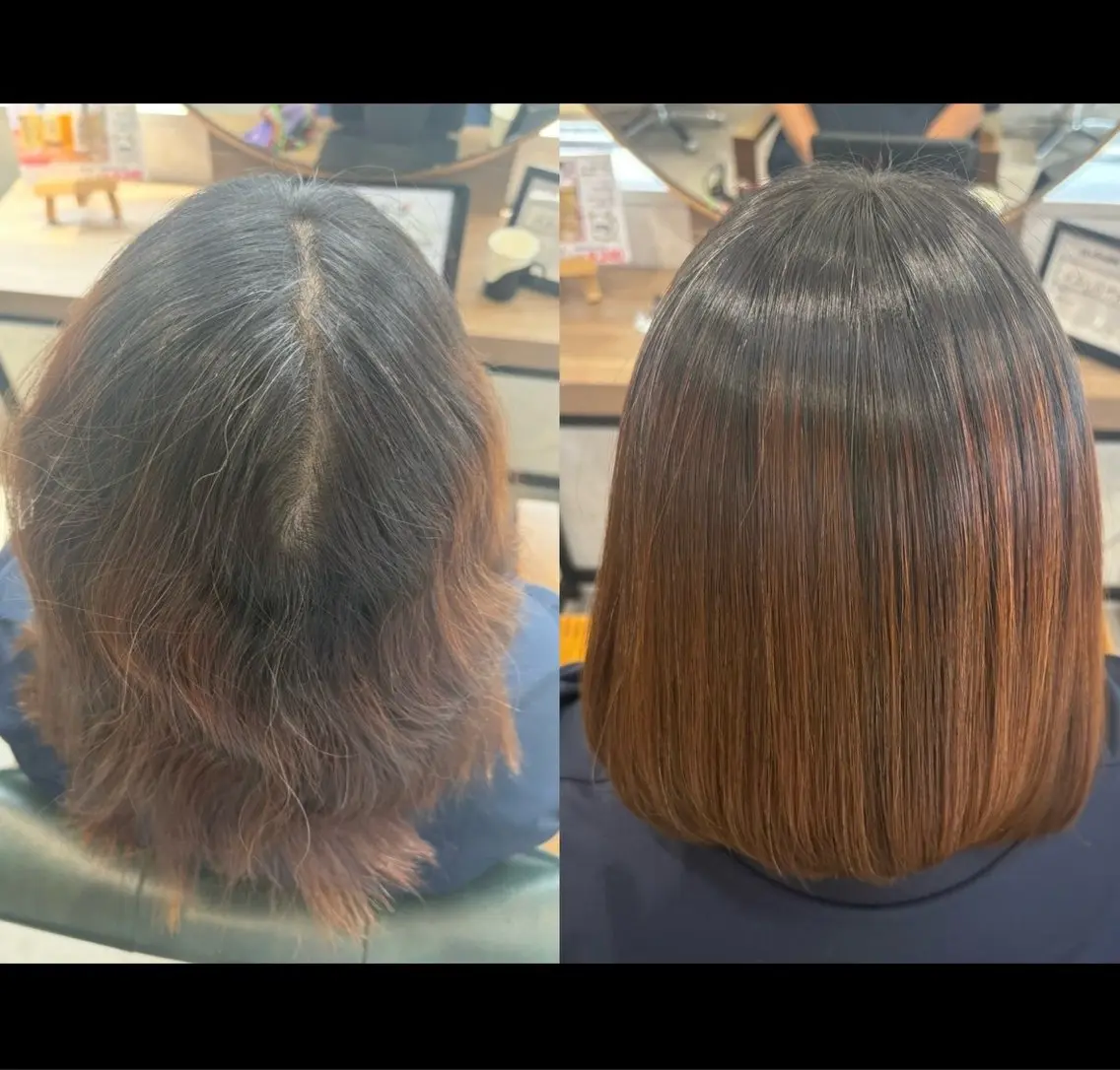 生えぐせ改善 黒木のヘアスタイル