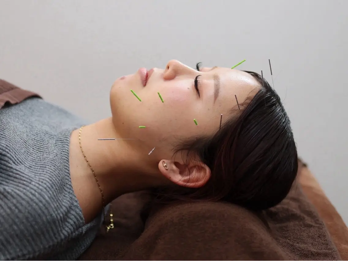 リラク 睡眠美容鍼・整体 Somniaそうすけのエステ・リラクイメージ