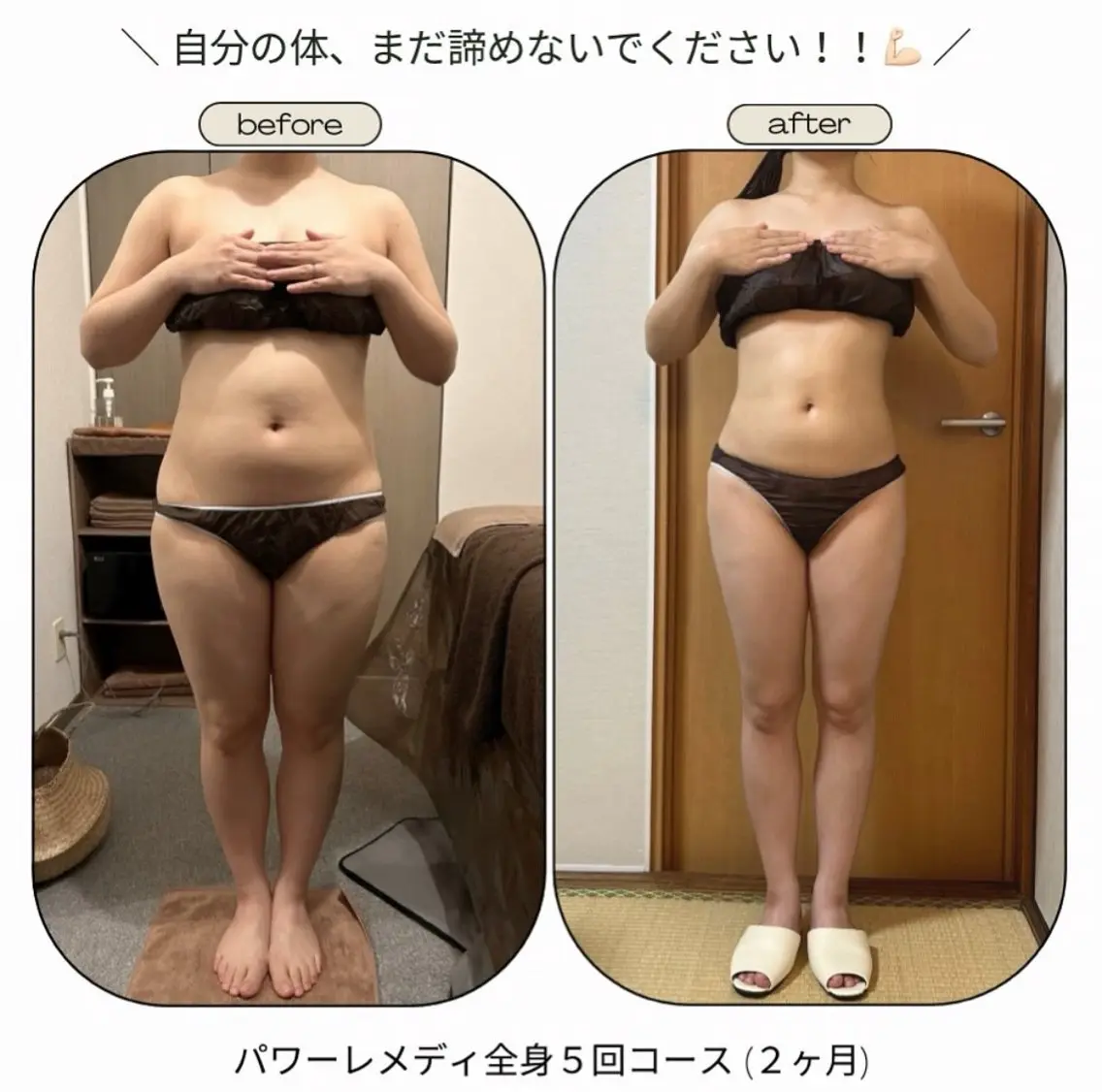 エステ リラク 《本気痩せ×疲労改善 》  BILOOPのエステ・リラクイメージ