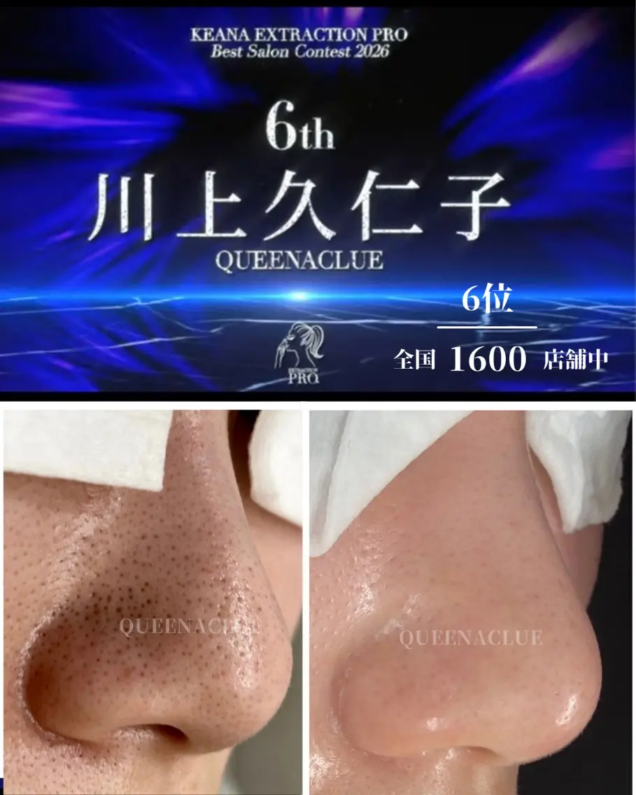 エステ 毛穴改善/脱毛 ネイル　川上久仁子のエステ・リラクイメージ