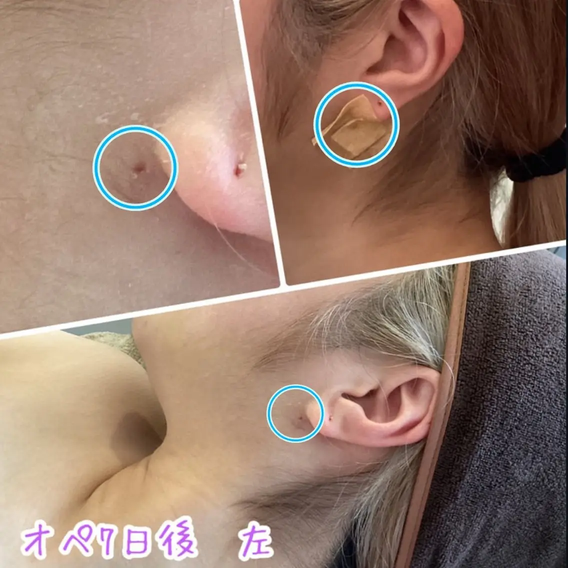 美容鍼&温活・免活 さくらんぼ鍼灸院のエステ・リラクイメージ