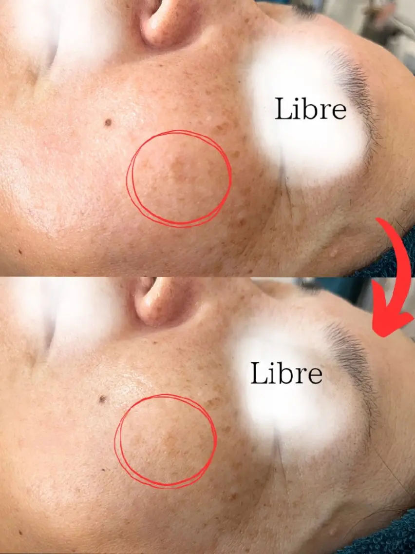 小顔コルギ&肌質改善 の専門店LIBREのエステ・リラクイメージ