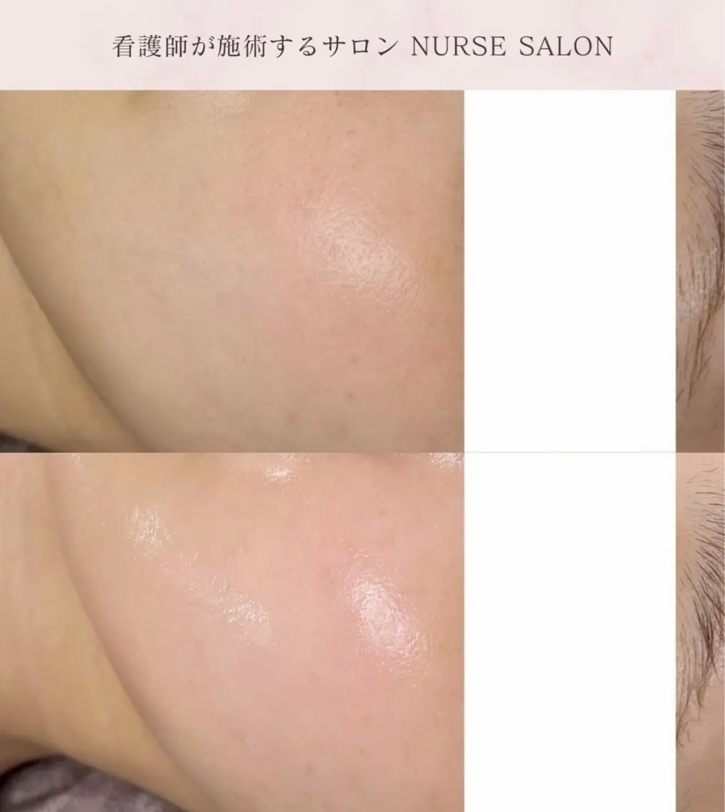 看護師が施術する美容 ナスサロ/mitoのエステ・リラクイメージ