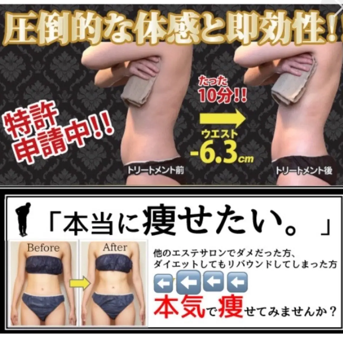 【結果重視の痩身!お好きな部位をお選び下さい】特許取得のハイレベルなマシンで結果を出します!の写真