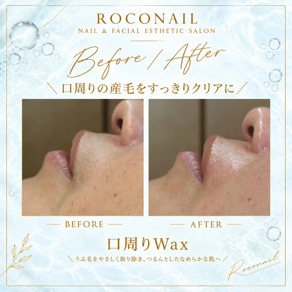 脱毛 roconail& WAX|ヒロコ鎌ヶ谷のエステ・リラクイメージ