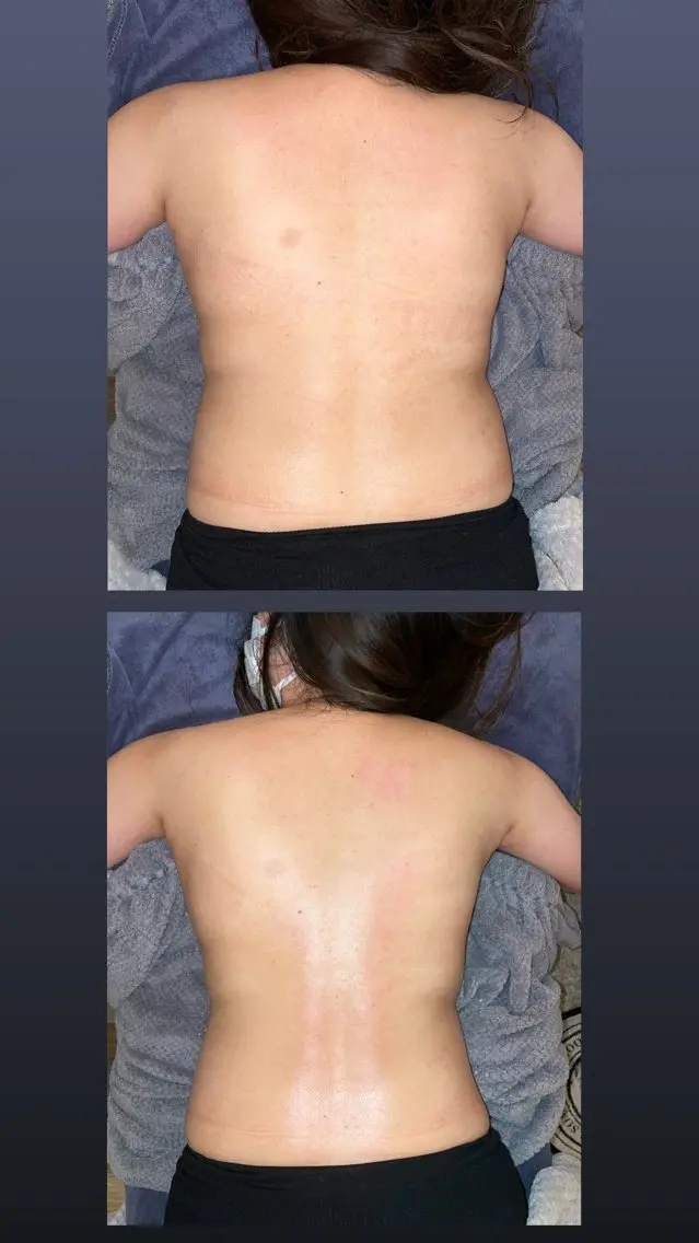 SHARES MADOKAのエステ・リラクイメージ
