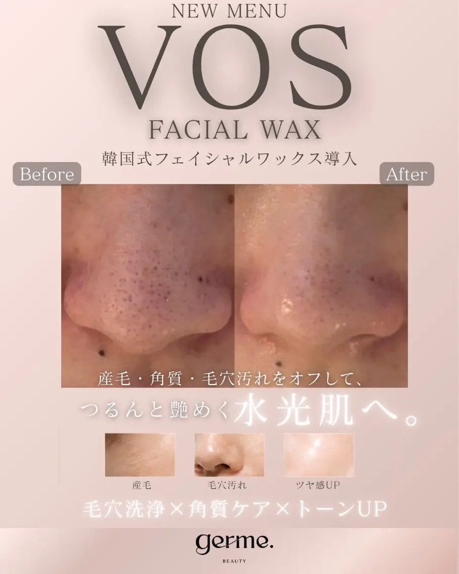 【全員｜産毛・ざらつき・くすみケア】フェイシャルワックスでつるんと透明感のある素肌へ🪞🩵の写真