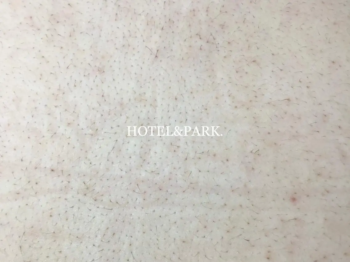 HOTEL&PARK . ワックス脱毛のエステ・リラクイメージ