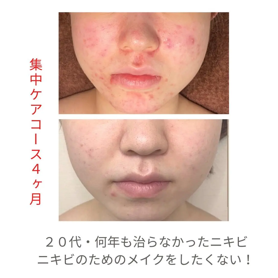 ベラージュ【美背中・ 美尻・フェイシャル】のエステ・リラクイメージ