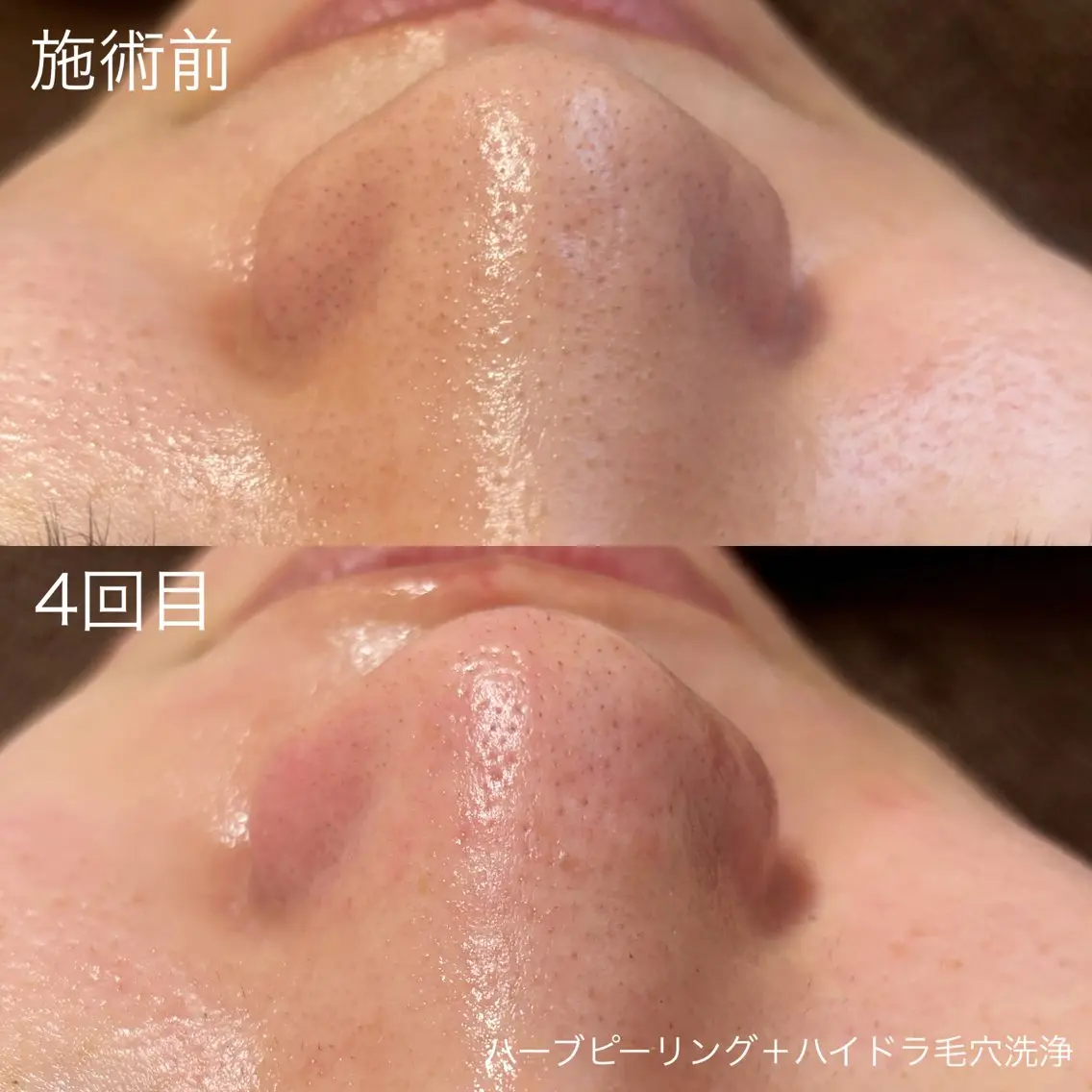 脱毛 lulula ricoのエステ・リラクイメージ