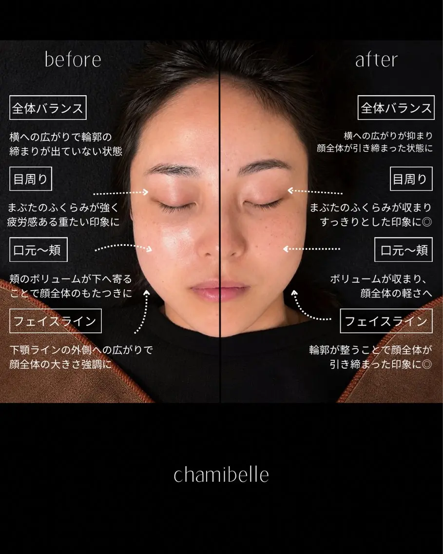 美容鍼灸サロン Chamibelleのエステ・リラクイメージ