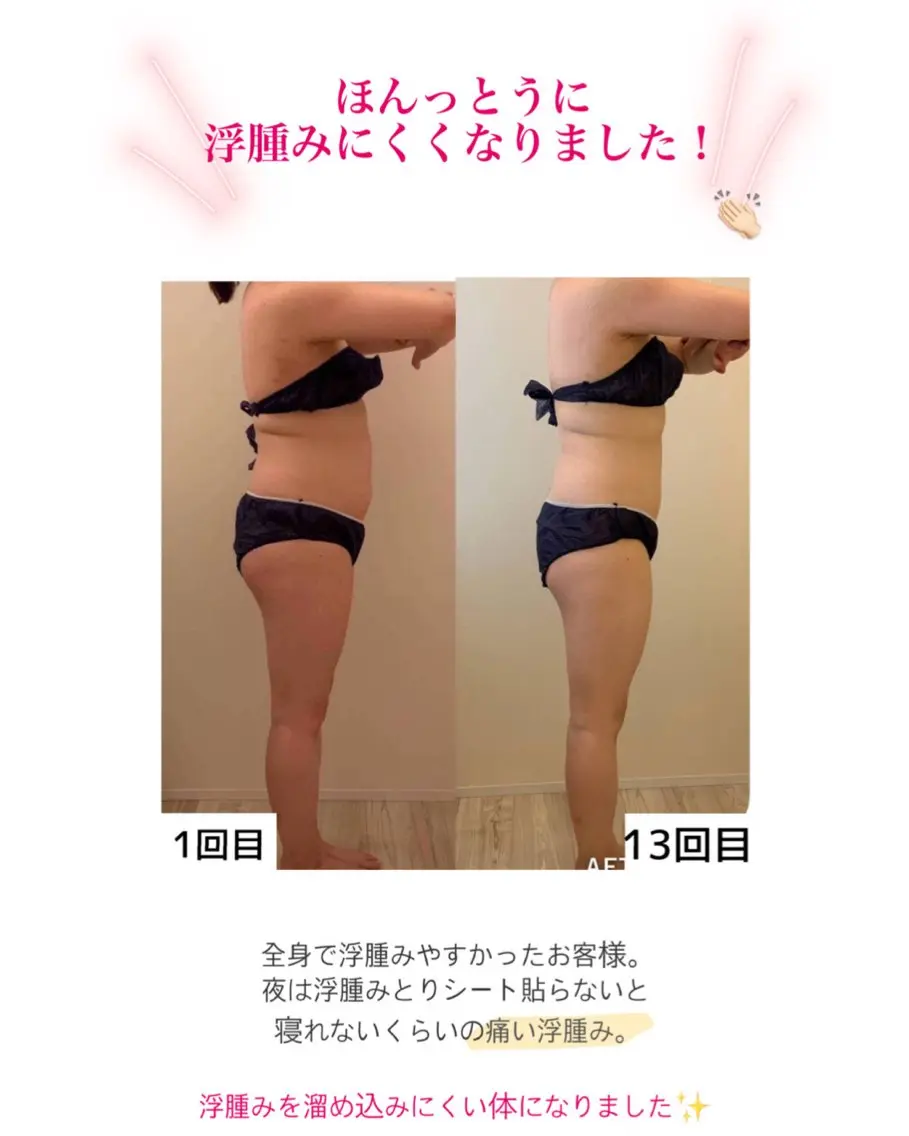 産後ダイエット−9㎏ Pourvous結衣のエステ・リラクイメージ