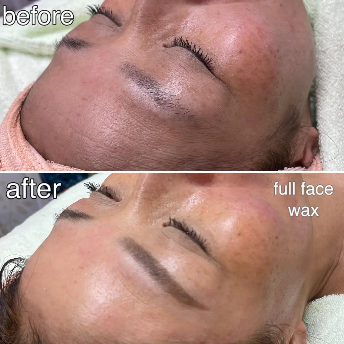 初回フェイシャルwax全額(眉は含まず)の写真