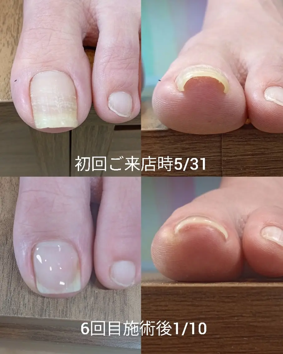 ネイル フットネイル 【まみ】 Ka Pilinaのネイルデザイン