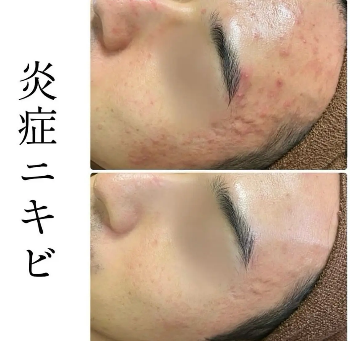 その他 ハーブピーリング専門 BIOPLUS+川崎のエステ・リラクイメージ