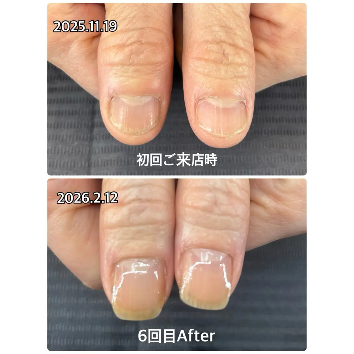 💅🏼自爪育成🌱通常コース(全７回)ホームケアセットプレゼント🎁の写真