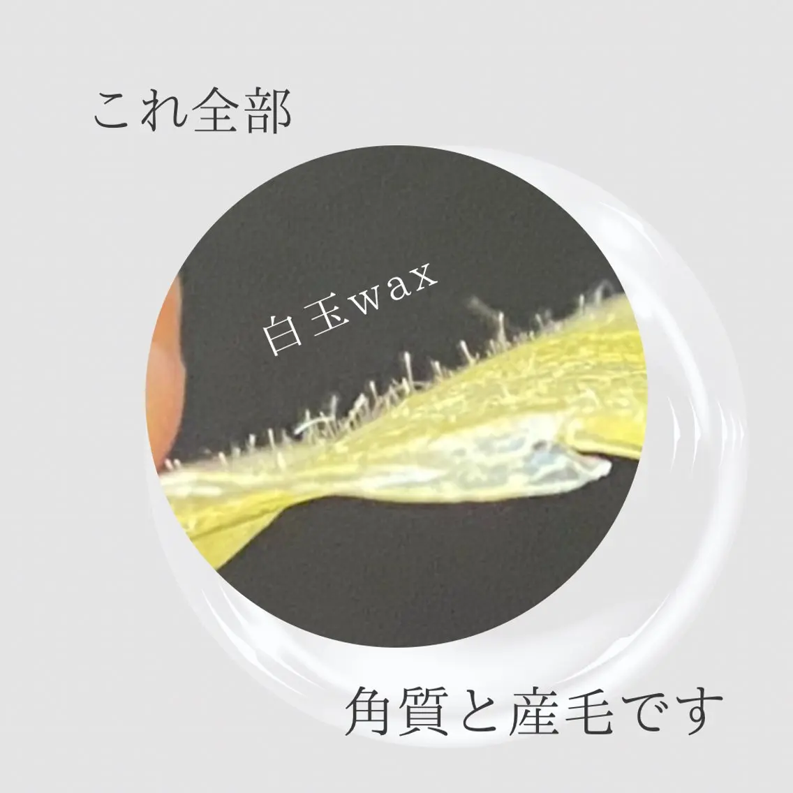 エステ リラク 韓国肌管理 【毛穴専科】のエステ・リラクイメージ