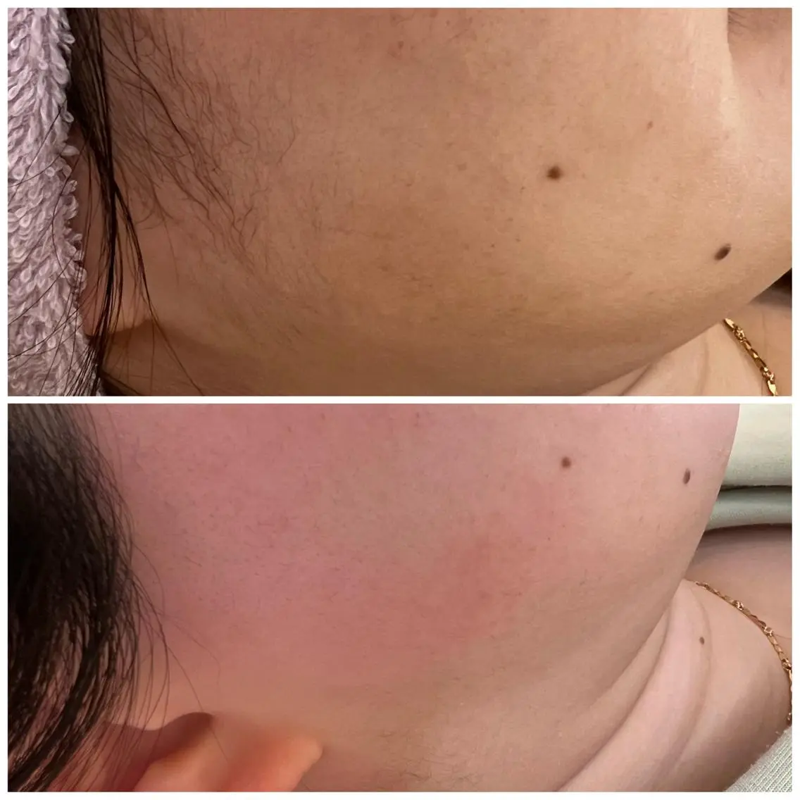 Dimples eyelashのエステ・リラクイメージ