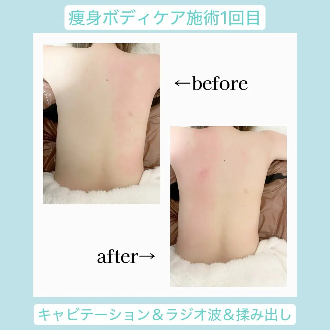 エステ 💜Karen PrivateSpaのエステ・リラクイメージ