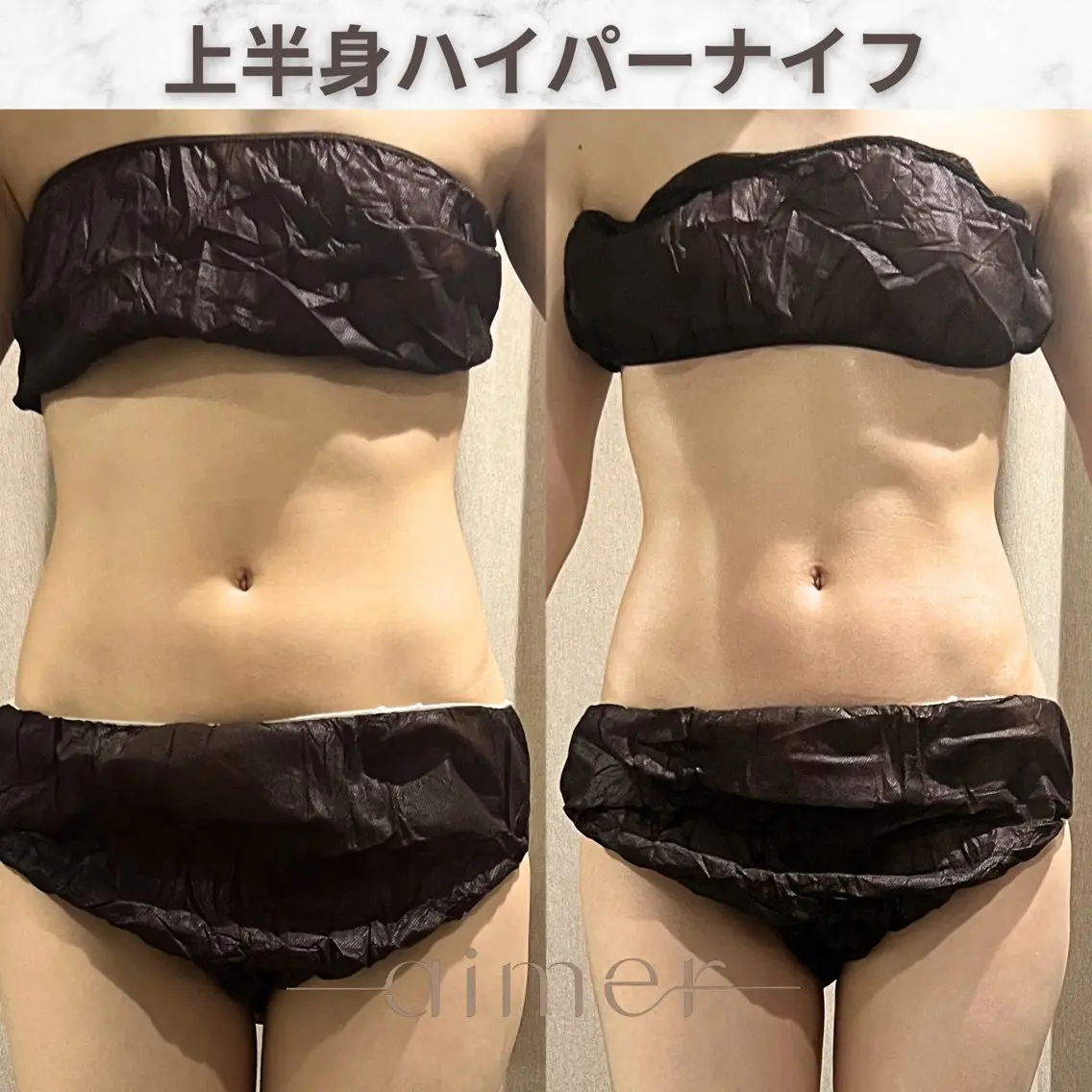 🌿‬期間限定🌿‬浮き輪肉  ◇ お腹ハイパーナイフ+リンパマッサージ※施術20分の写真