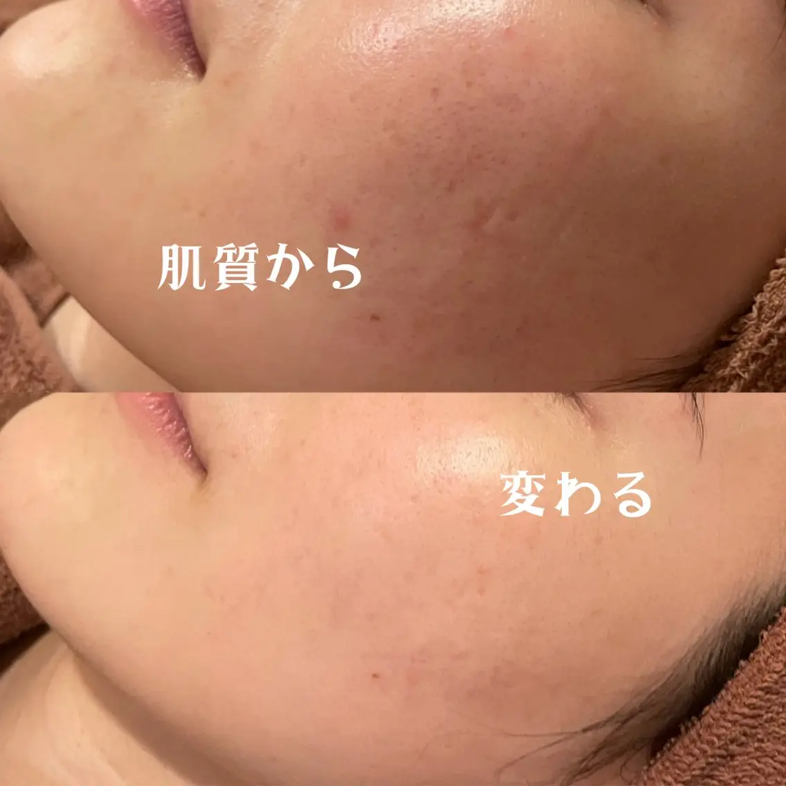 【新社会人クーポン💐】社会人になったそこのあなた⭐️疲れた肌癒しませんか？の写真