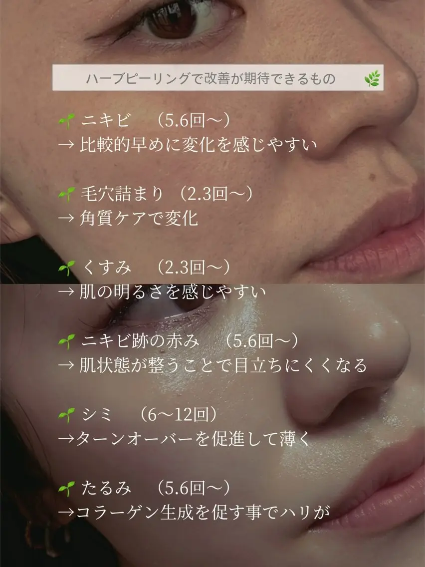 エステ 艶肌デトックス🫧 Samiraのエステ・リラクイメージ