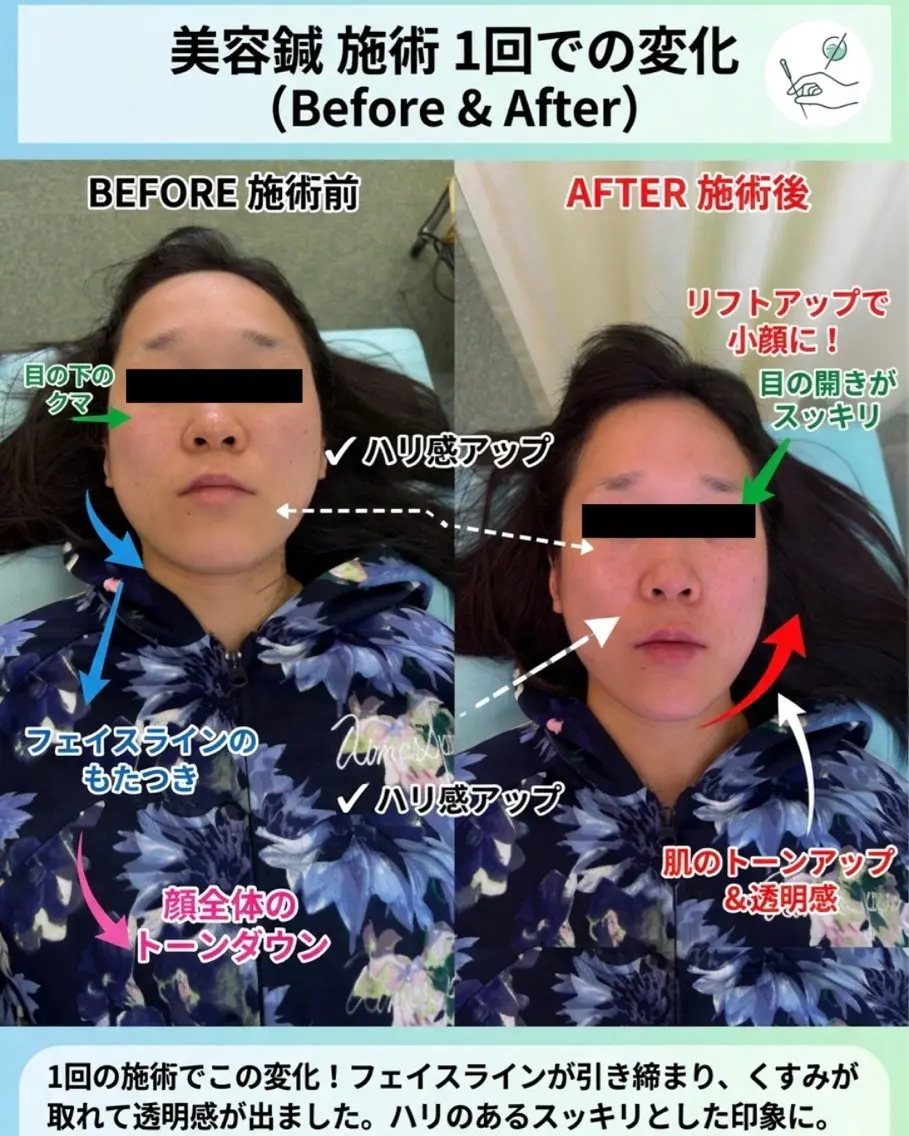 あおぞら 鍼灸整骨院のエステ・リラクイメージ
