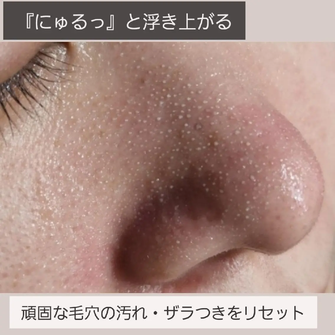 【毛穴洗浄+美白マスク】透明感◎ツルツル感動毛穴にの写真