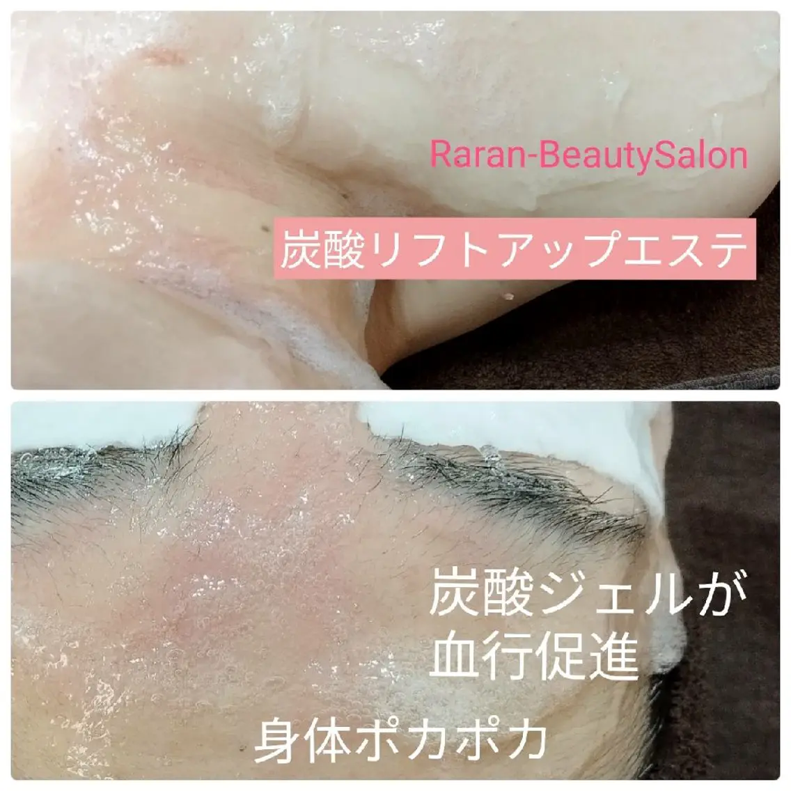【ミネラル炭酸美容* リフトアップコース】 美白✨リフトアップ✨コリ✨シミ✨の写真