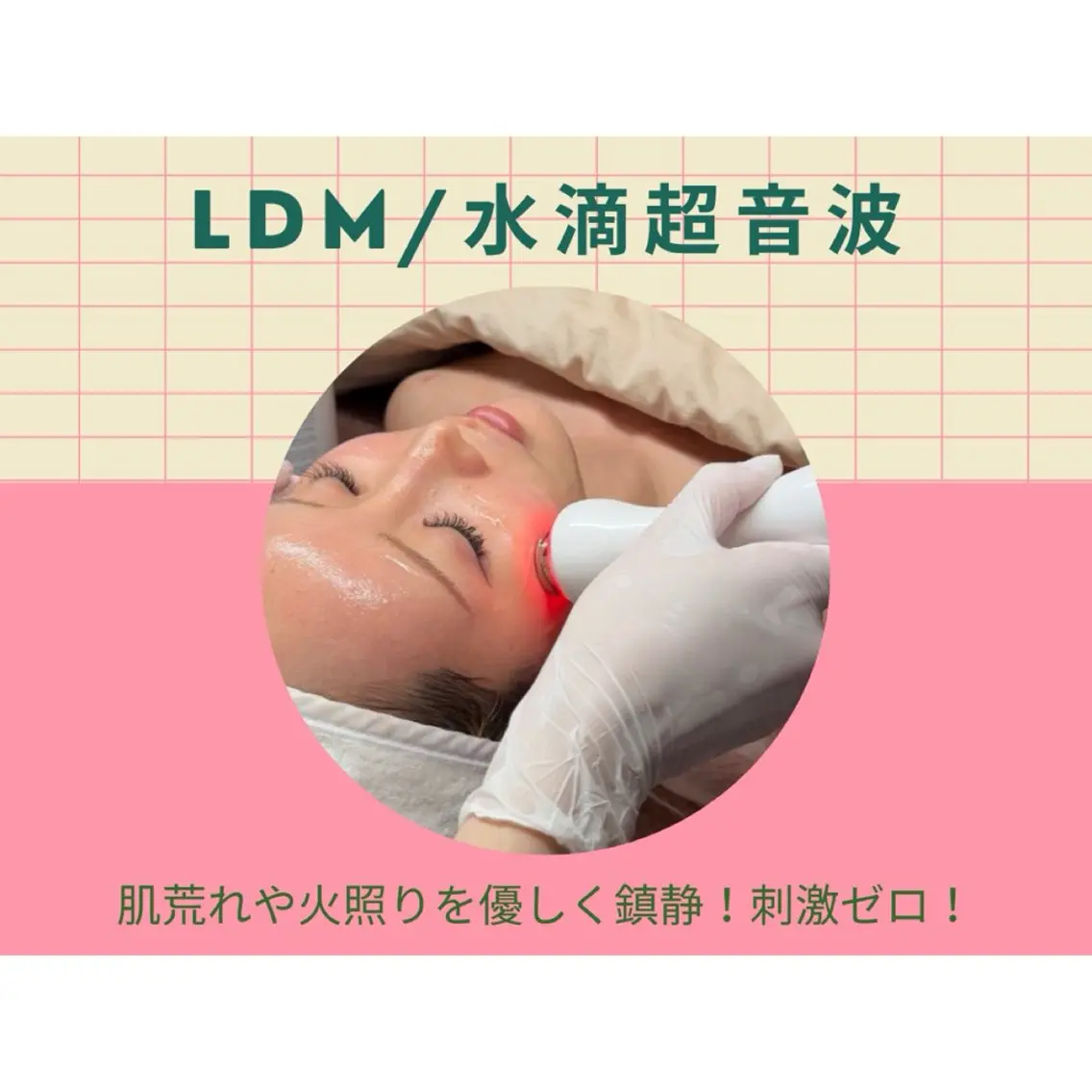 【肌荒れ・ニキビ・赤み】LDM水滴超音波💧鎮静ケアの写真
