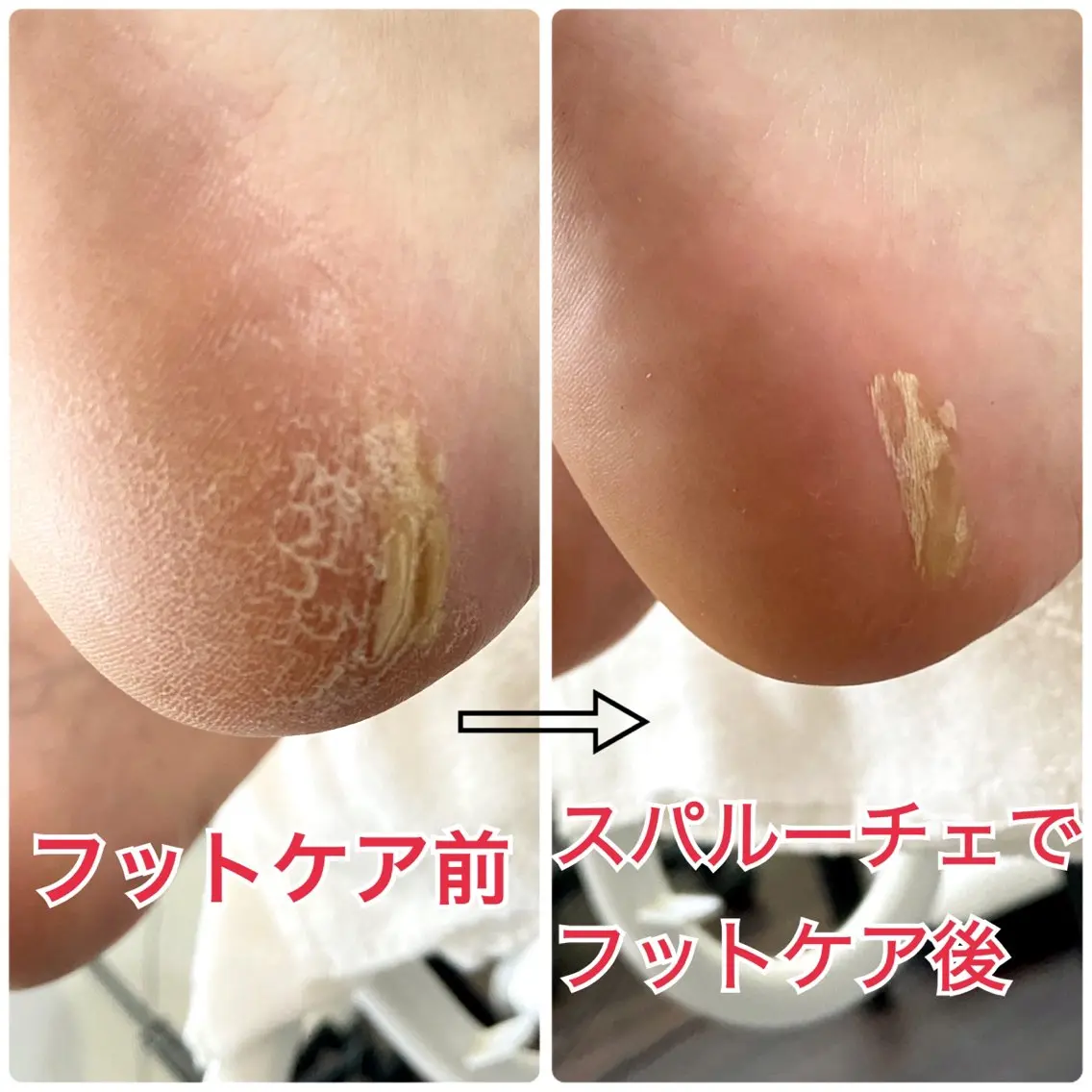 ネイル フットネイル Lotus Nailのネイルデザイン