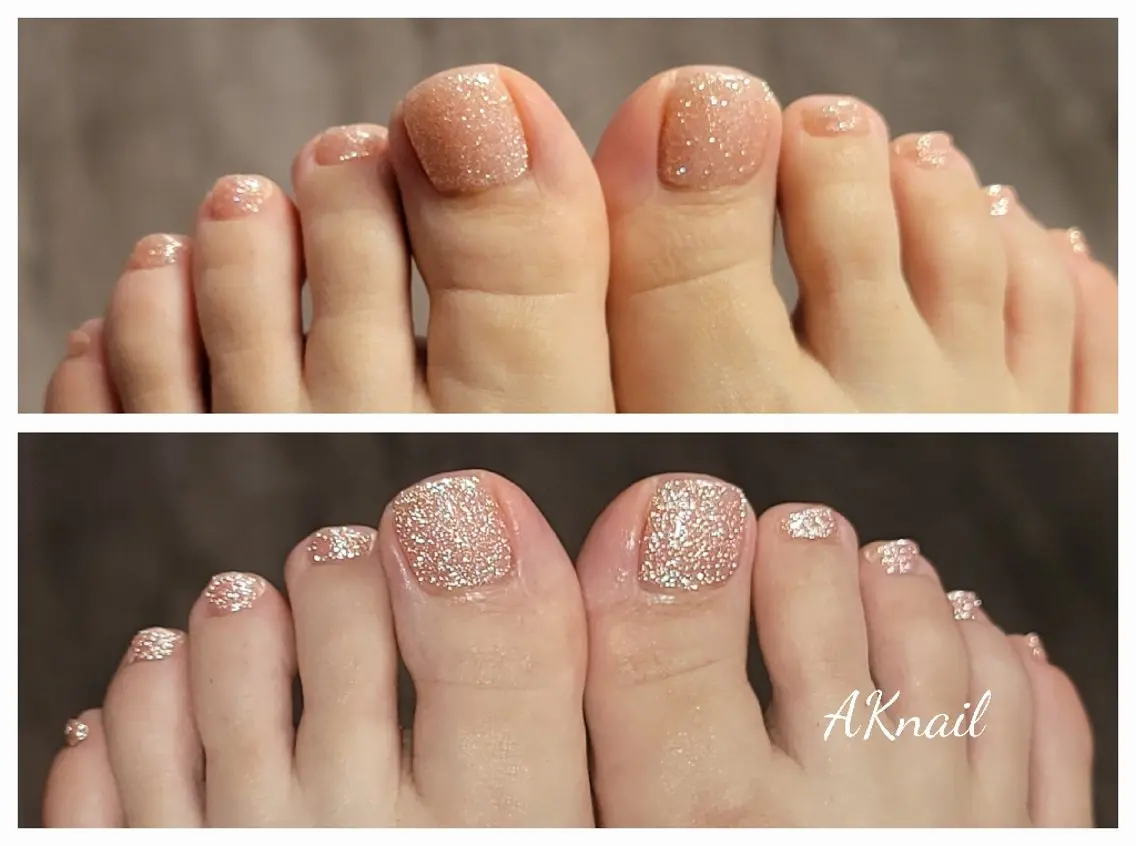 ネイル フットネイル ネイル&巻き爪サロン AKnailのネイルデザイン