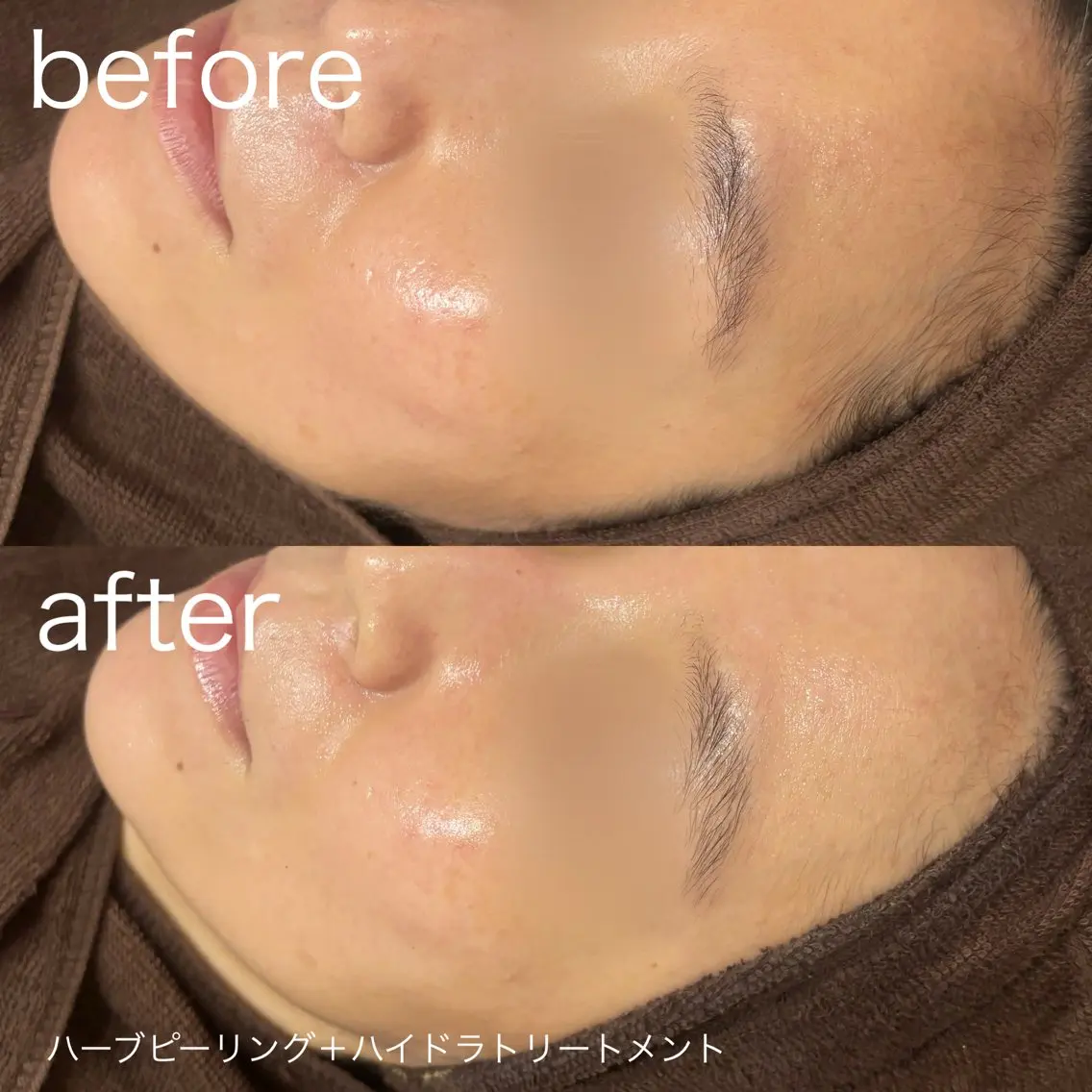 脱毛 lulularico Yuのネイルデザイン