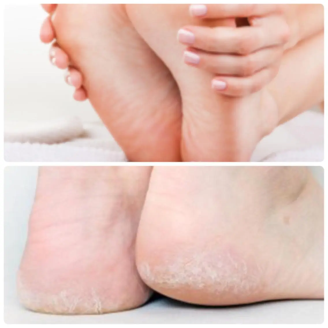 フット👣足裏の角質除去　ツルツルふわふわ仕上げにオイル保湿仕上げの写真